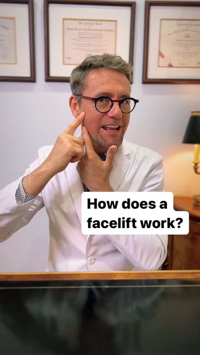 How does a facelift actually work? #faceliftnyc #faceliftsurgery #faceliftspecialist #faceliftexpert #plasticsurgery