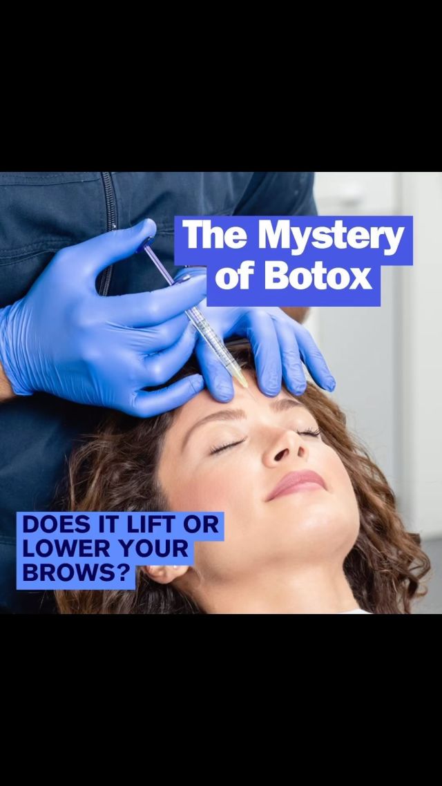 Diving into the Botox mystique! In my latest blog post, ‘The Mystery of Botox: Does it Lift or Lower Your Brows?’ I unravel the enigma behind this popular treatment. Join me as we explore the science and artistry of facial rejuvenation. #BotoxRevealed #BrowTransformation #expertinsights