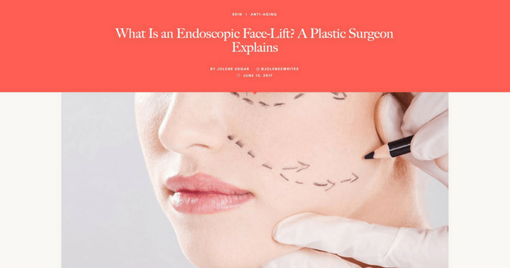 Dr. Konstantin Dr. Konstantin’s Endoscopic Facelift is Featured in Allure Magazine