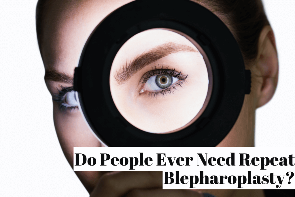 Dr. Konstantin Do People Ever Need Repeat Blepharoplasty?