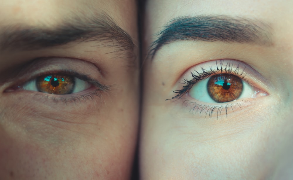 Dr. Konstantin Vasyukevich Droopy Eyelid After BOTOX