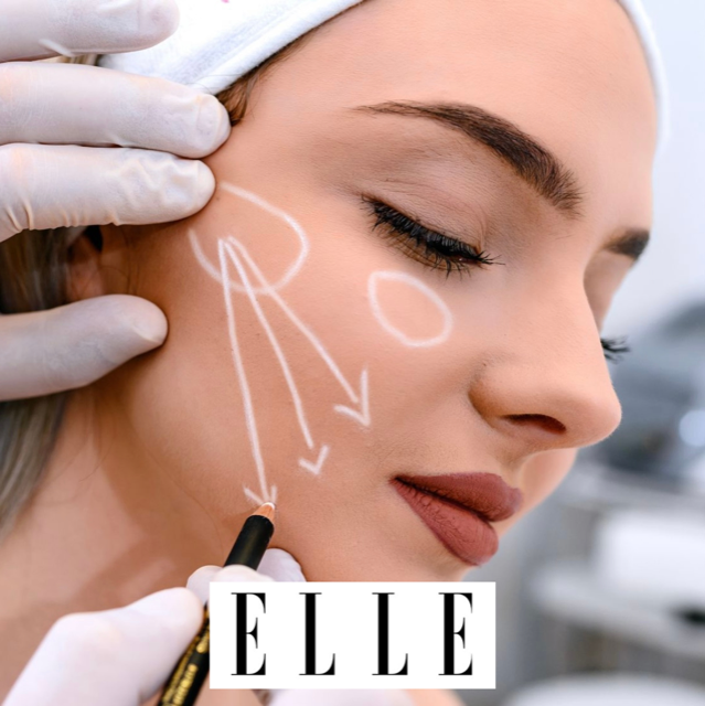Dr. Konstantin Vasyukevich Dr. Konstantin in ELLE: Spotlight On Buccal Fat Pad Removal