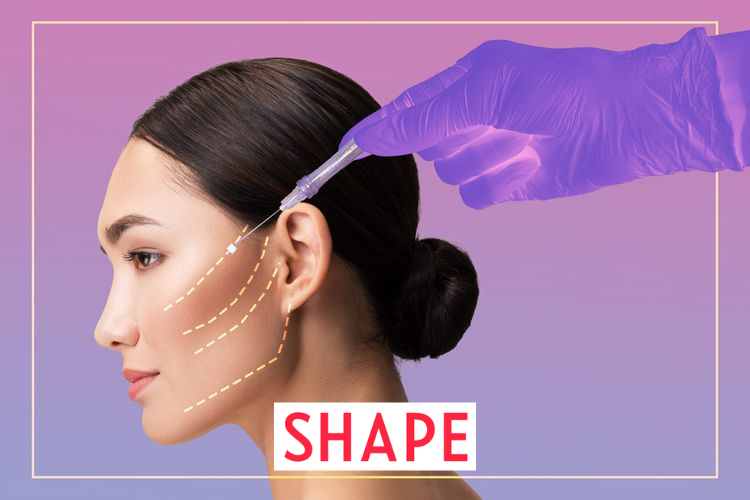 Dr. Konstantin Vasyukevich Dr. Konstantin in SHAPE Magazine: The Thread Lift Facelift – Everything You Need To Know