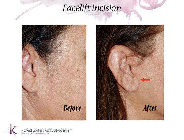 Patient Results 2
