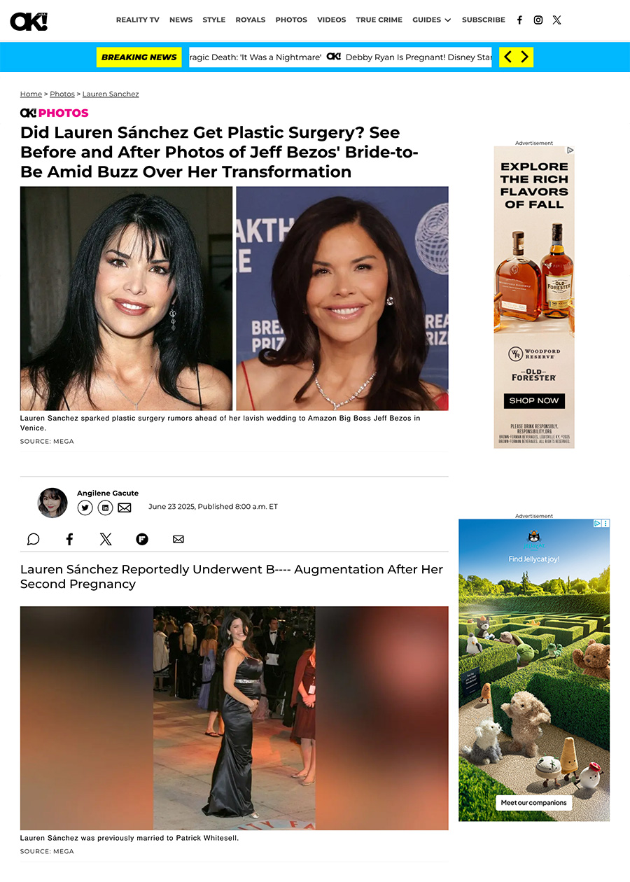 Did Lauren Sánchez Get Plastic Surgery? See Before and After Photos of Jeff Bezos' Bride-to-Be Amid Buzz Over Her Transformation - Article